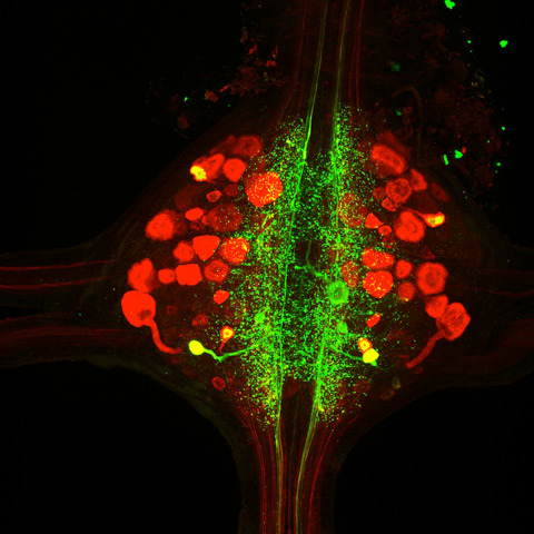 immunoreactive cells