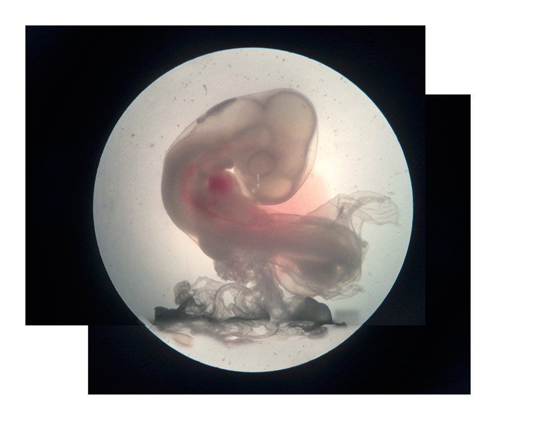 Photo taken under a dissection microscope in a Bio 1 Lab of a chick embryo 3 weeks after fertilization.