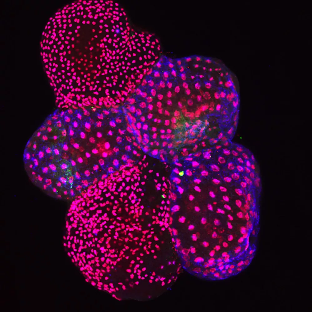 propidium iodide-stained DNA