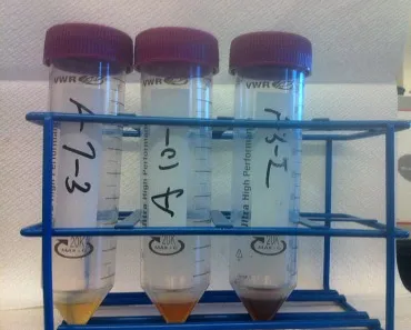 Test tubes filled with the substances extracted from the surface of US $1 bills.