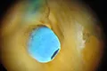Scallops (family Pectinidae) have the most acute visual sensory organs of any bivalves.