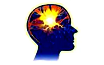 Is the Mind Inside the Head?